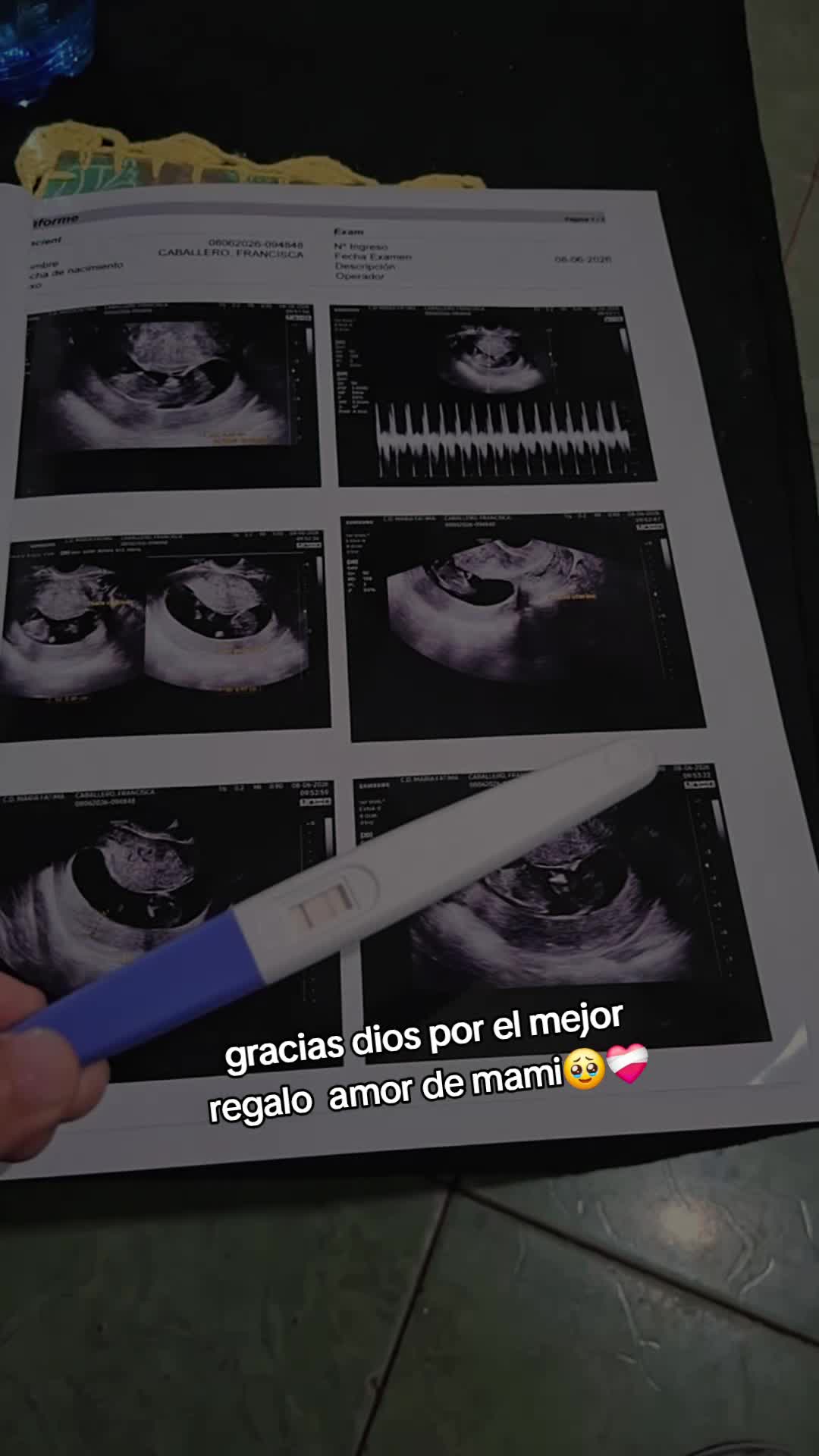 @Caballero FCR😻🙈❤