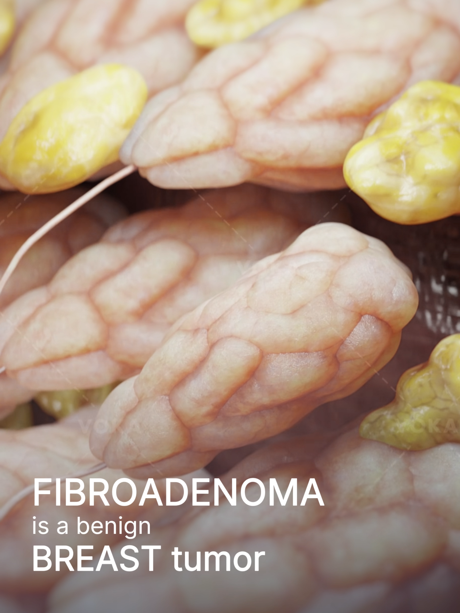 @VOKA 3D Anatomy & Pathology