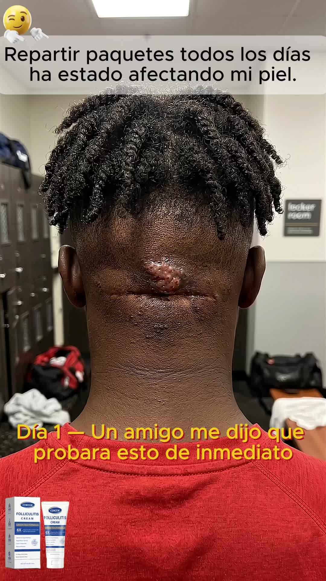 @CJMJIM.ScalpCare10