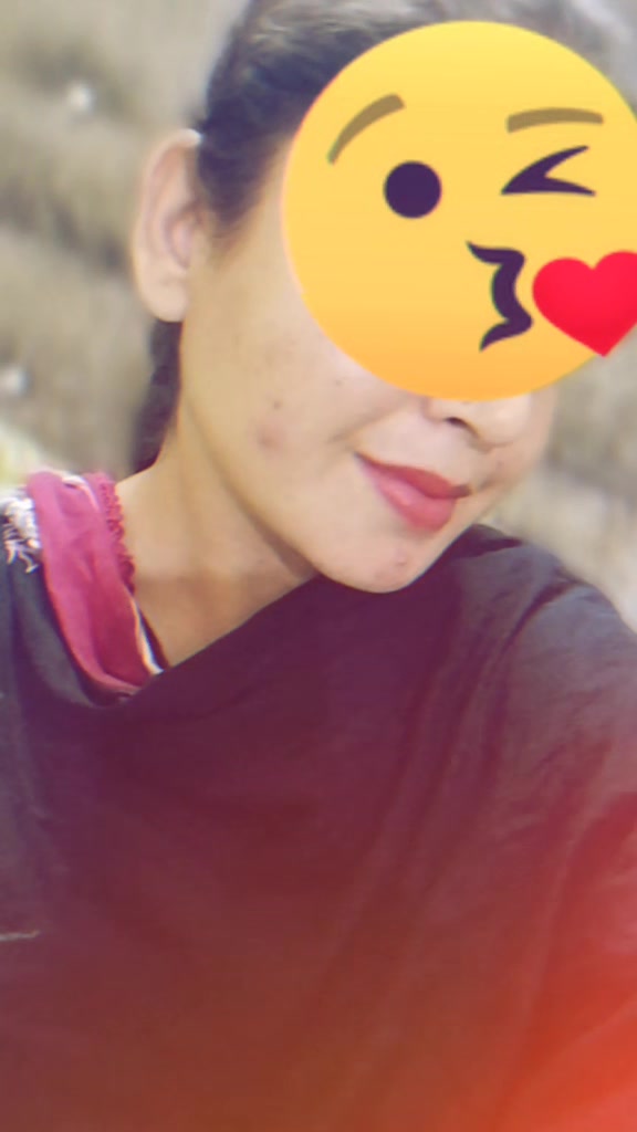 @๐ฆข๐โจ