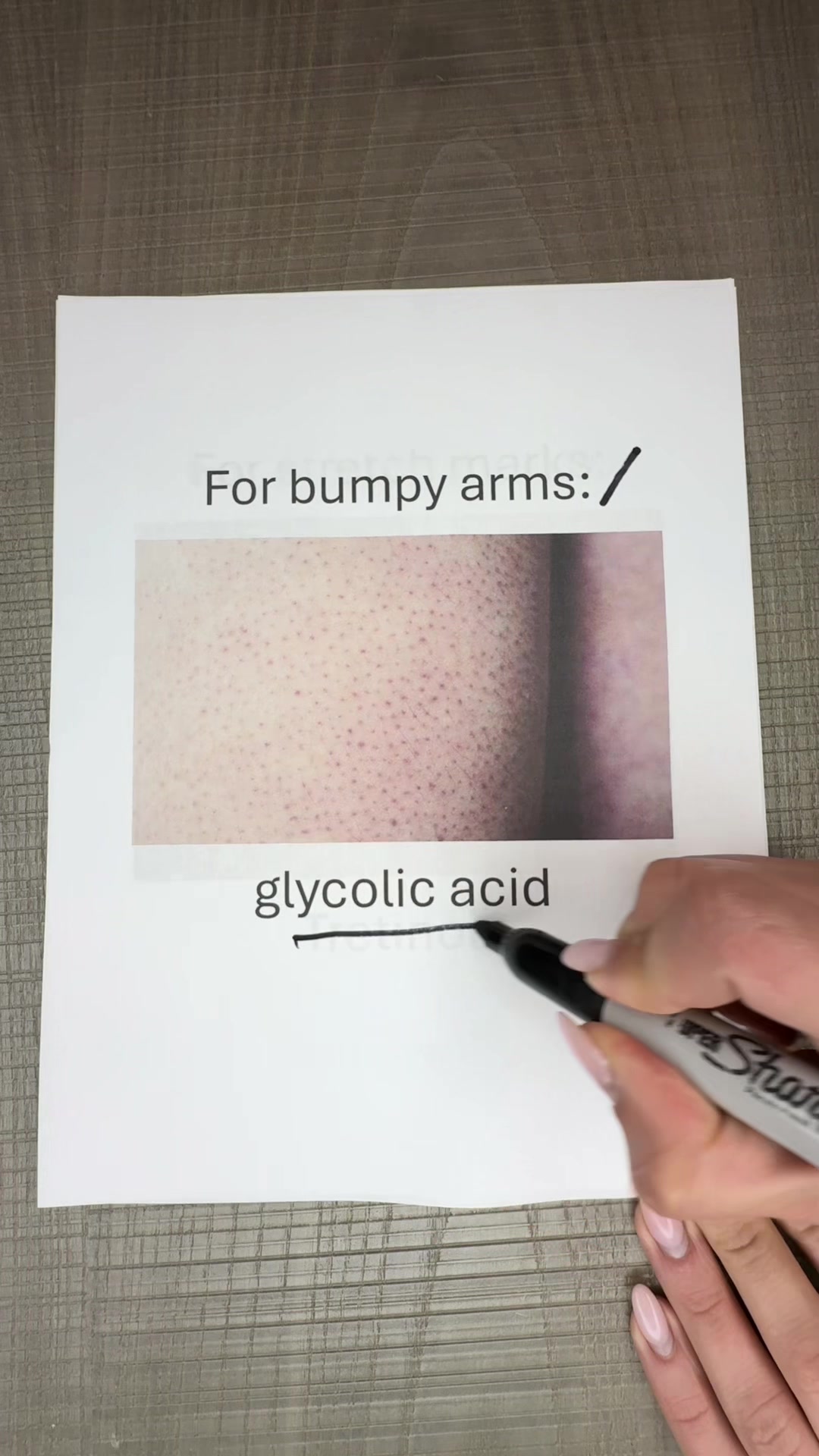 @Dermguru