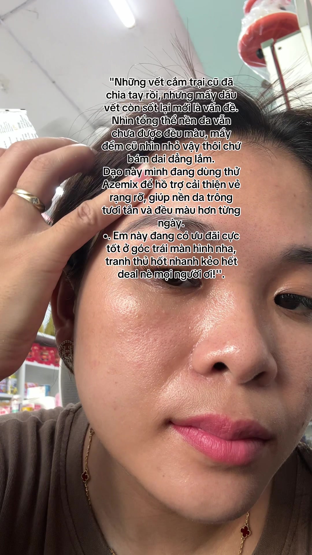 @Hoa Acne Skincare🌷