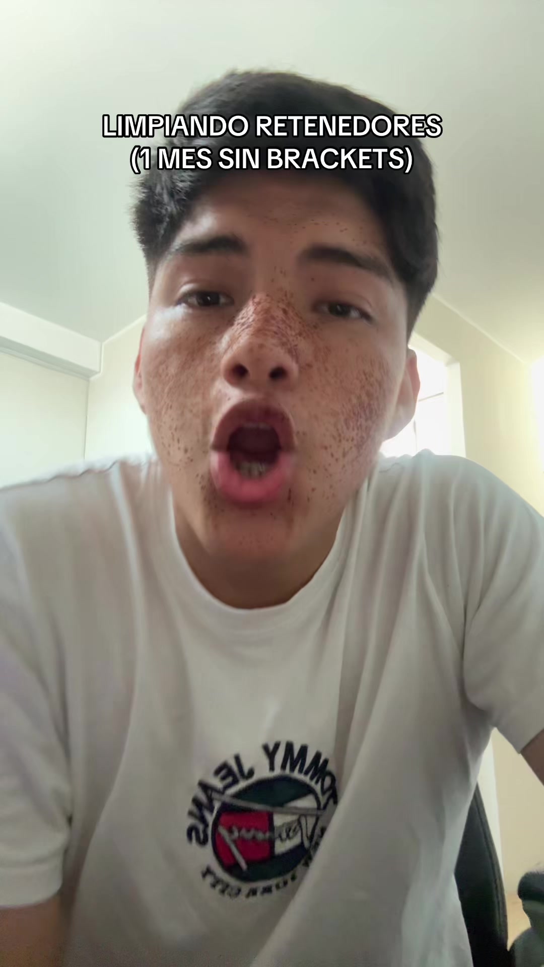 @Nicolasvill