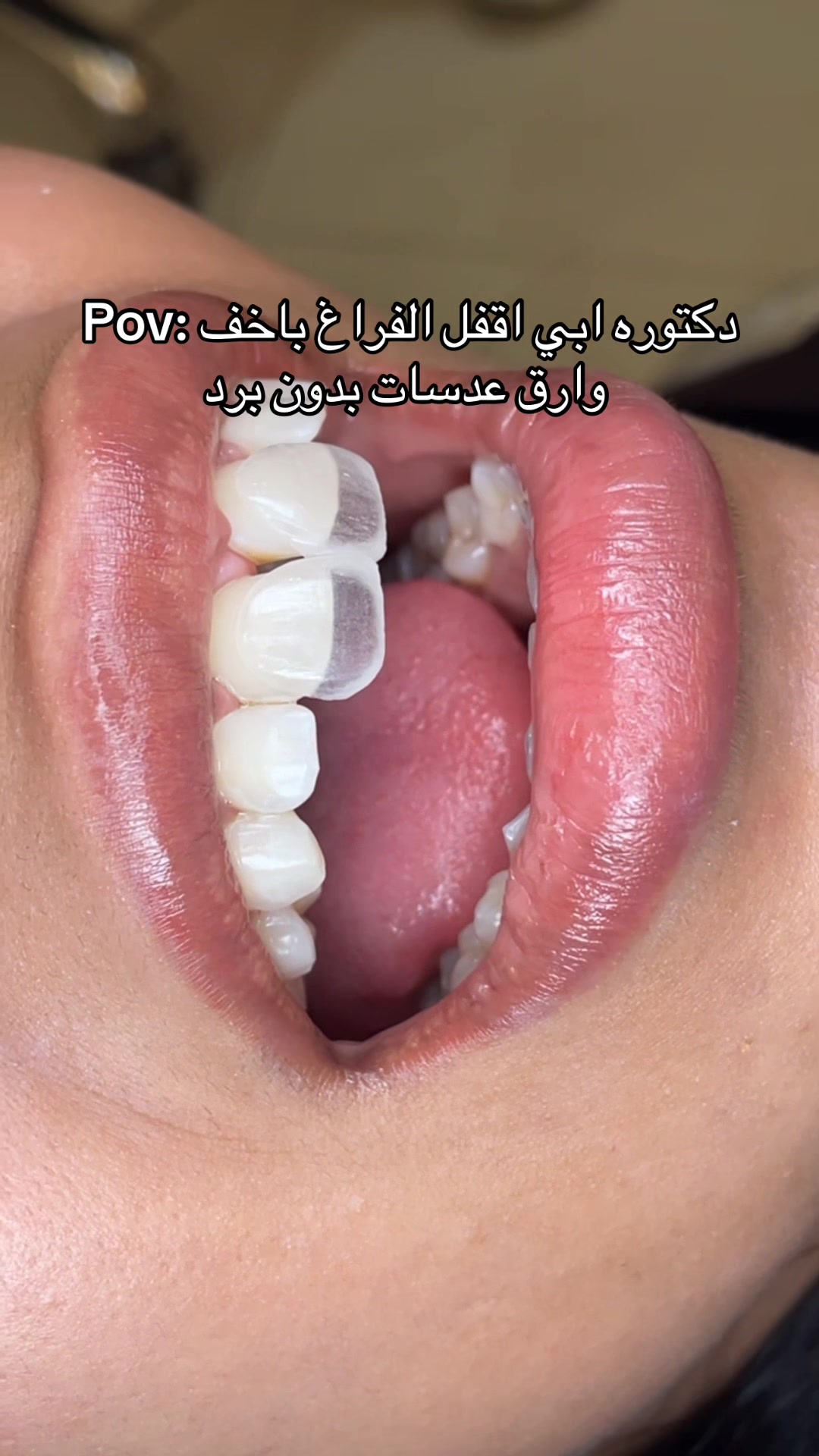@Dr. Abrar Alhababi