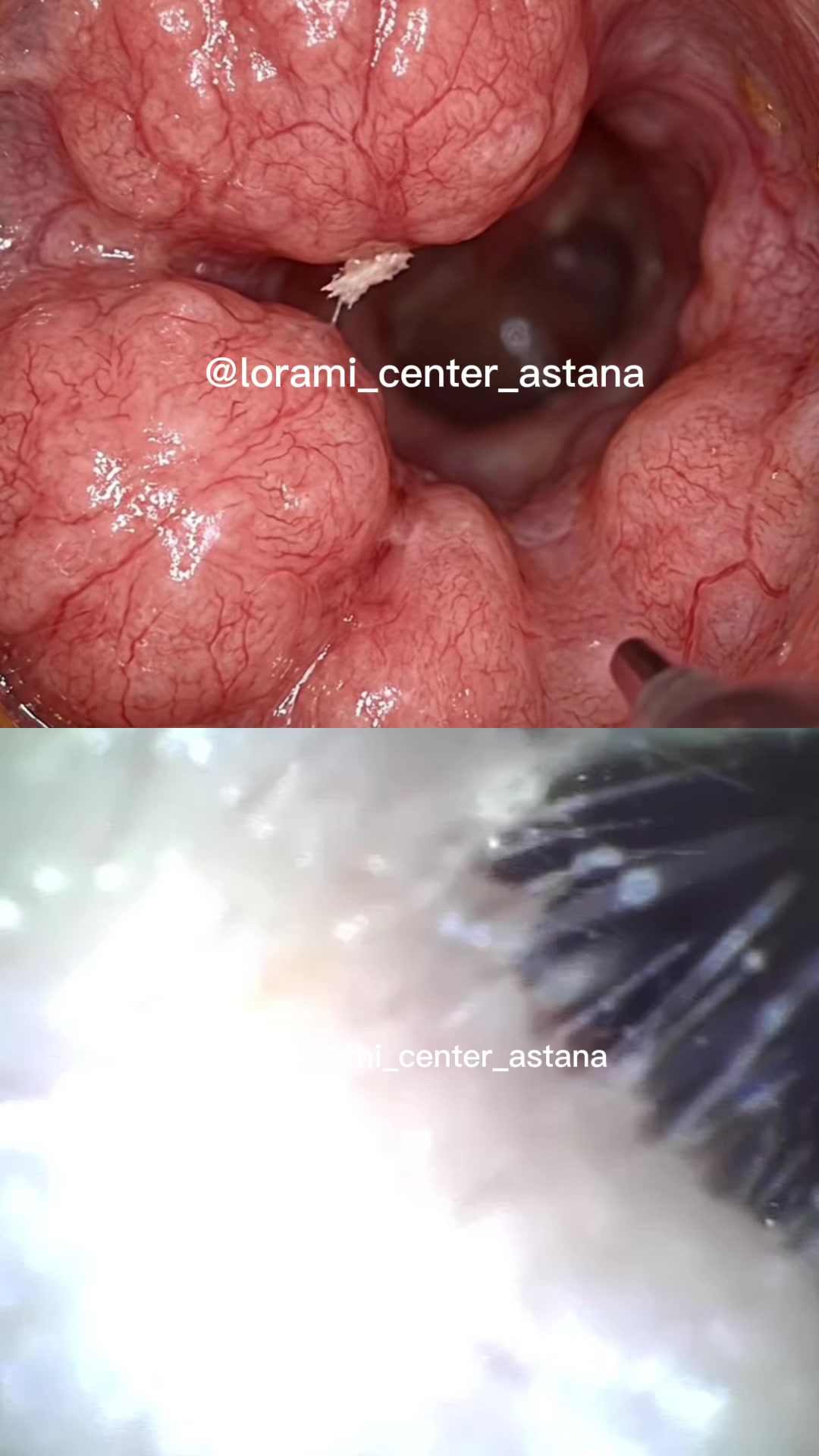 @Lorami_center_astana