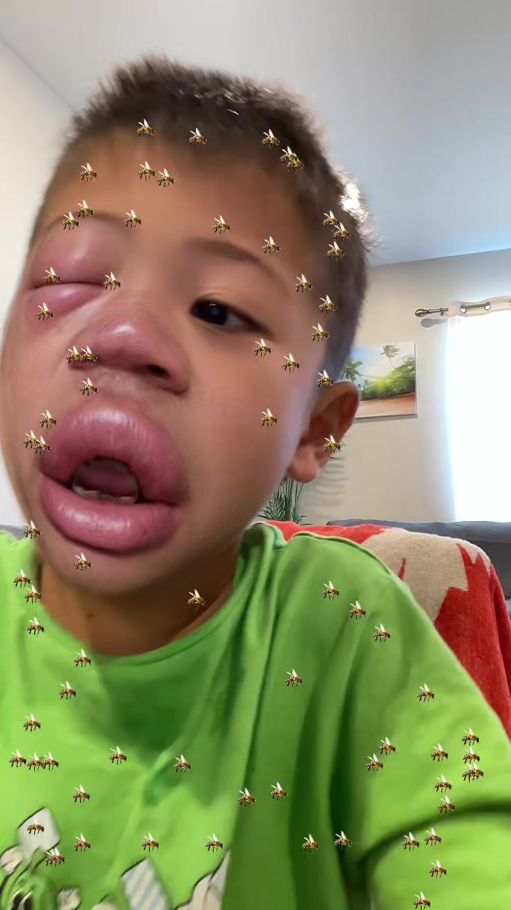 @Xee