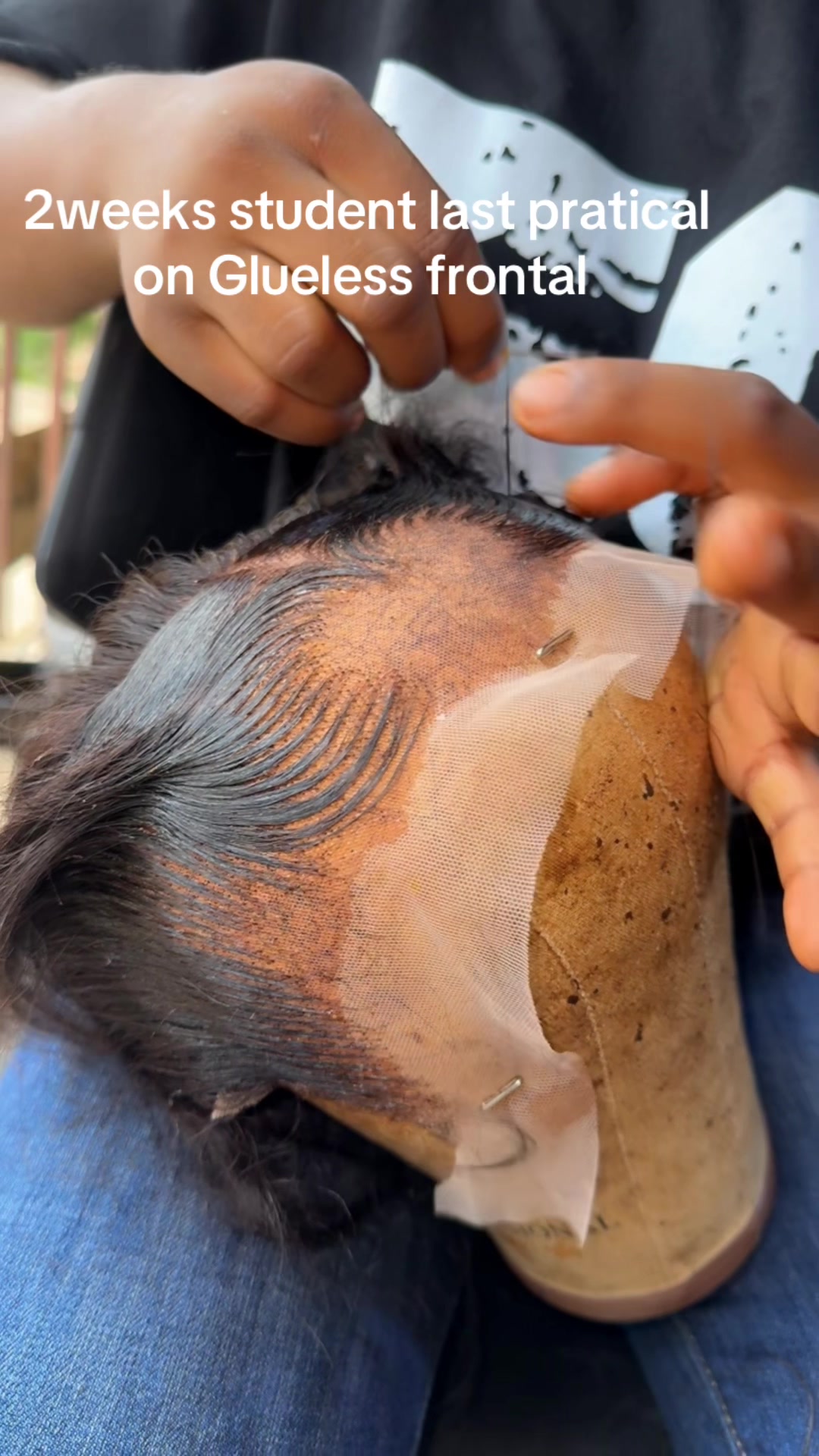 @Williams hairline