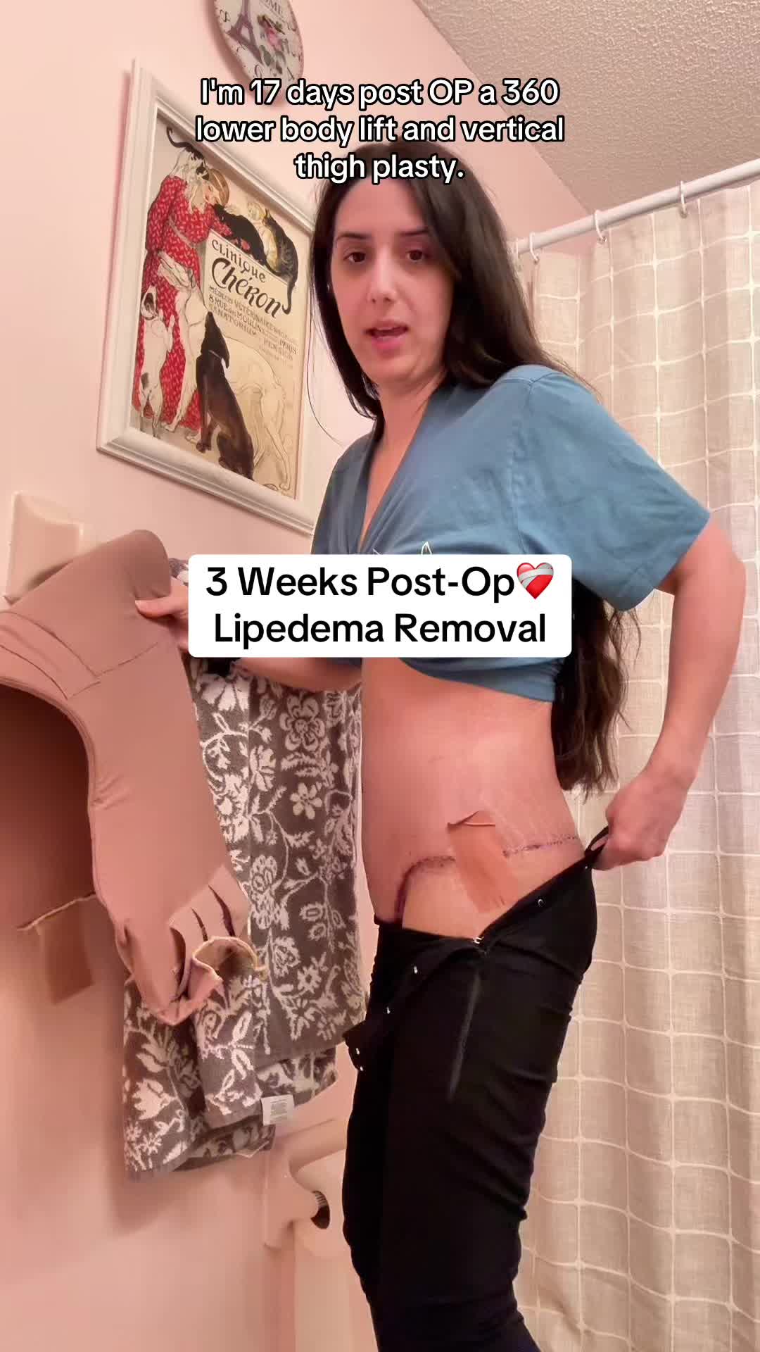 @Heather 𖤓 PCOS Princess