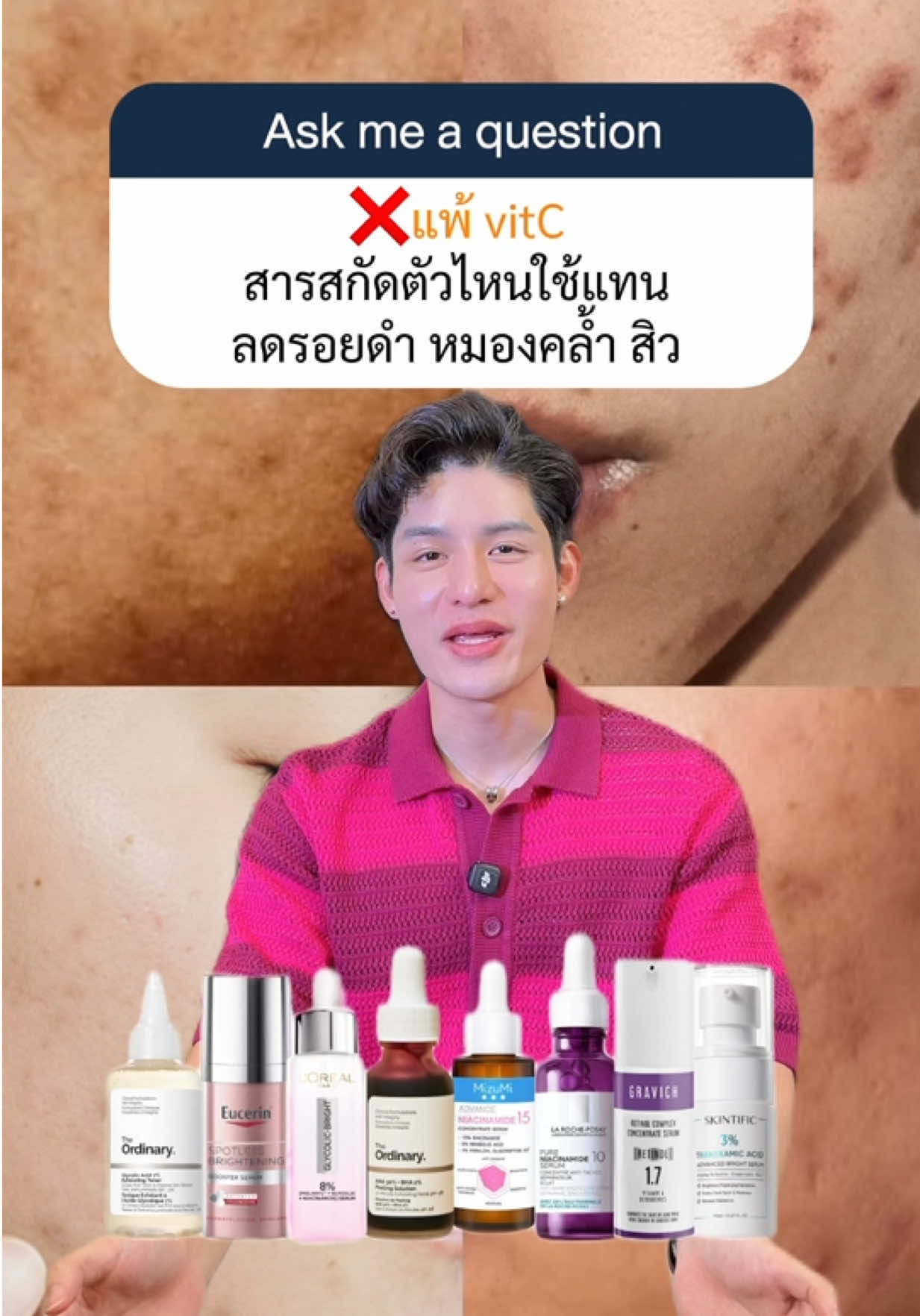 @หนูปอนด์ที่ชอบเลเซ่อร์