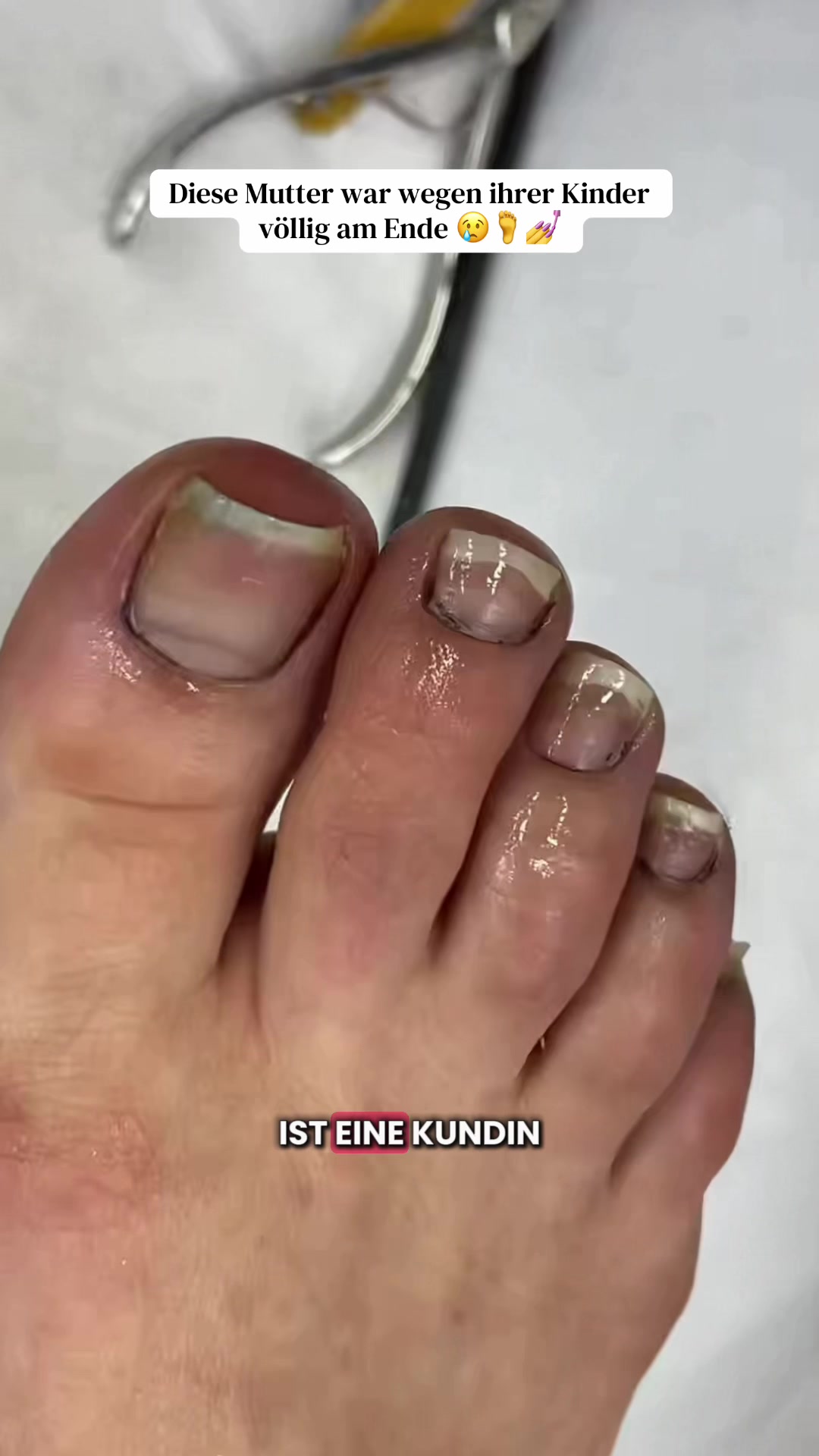 @NagelMoment