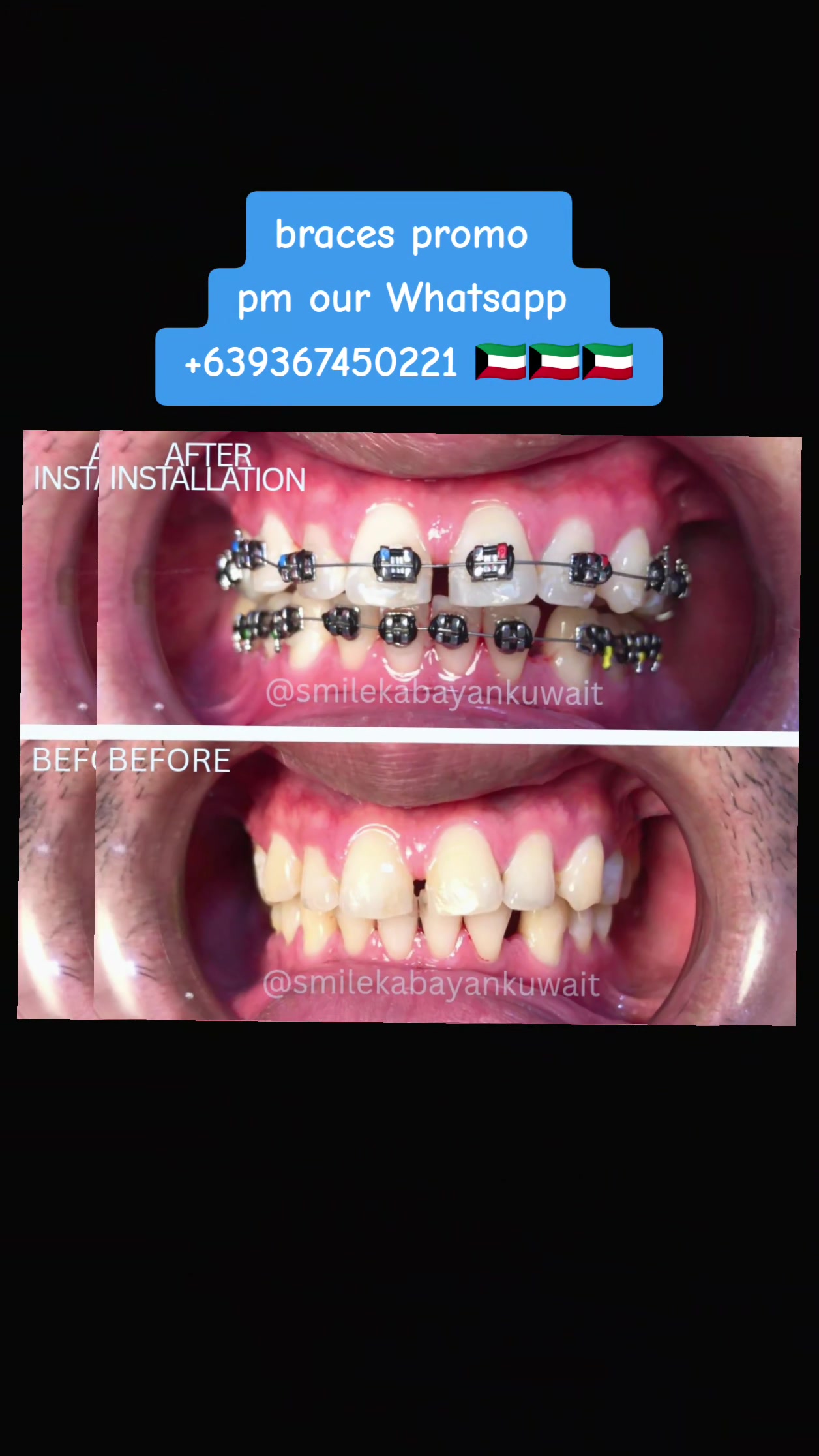 @SmileKabayanKuwait🇰🇼