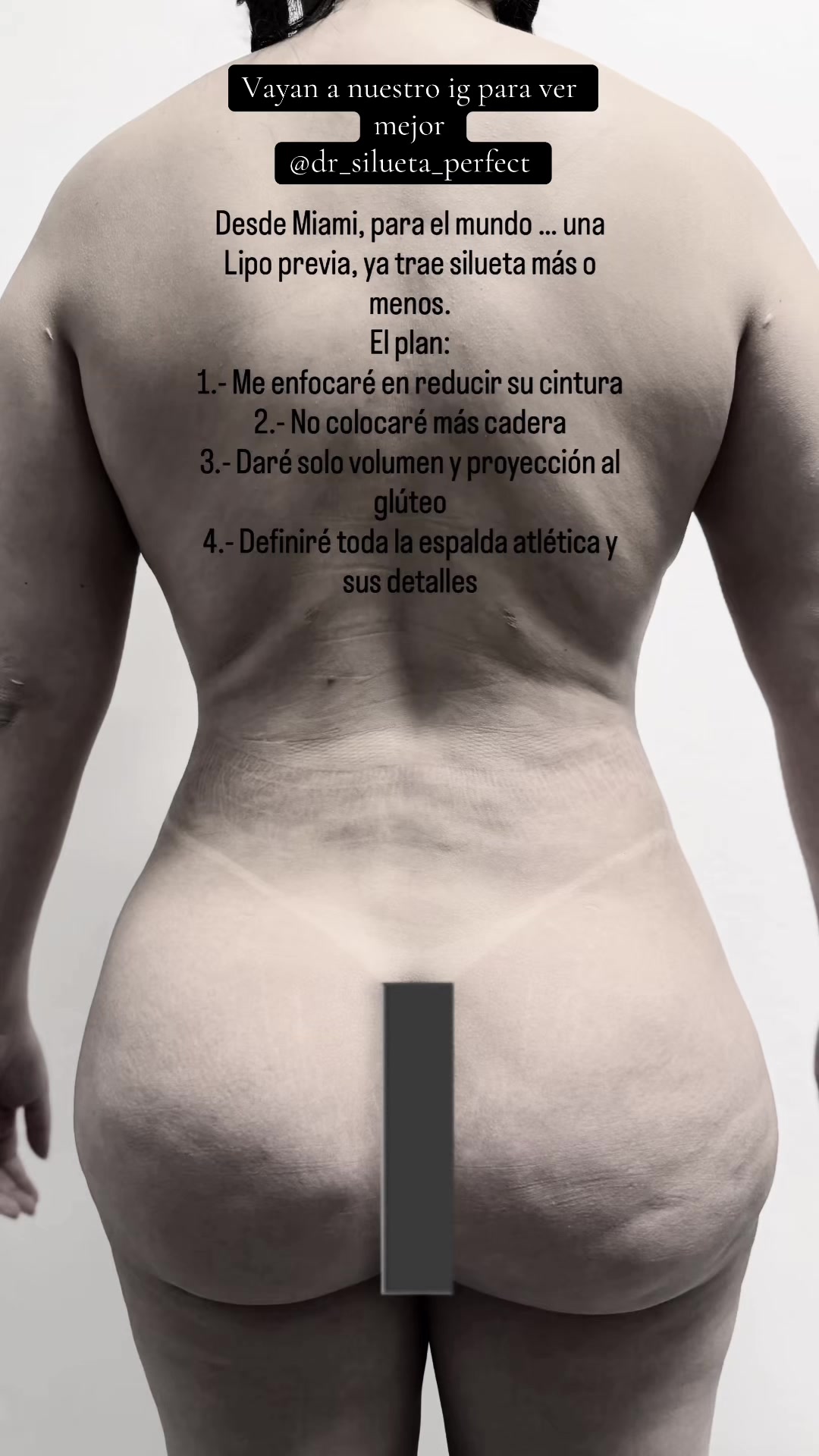 @Firma de la “I” latina