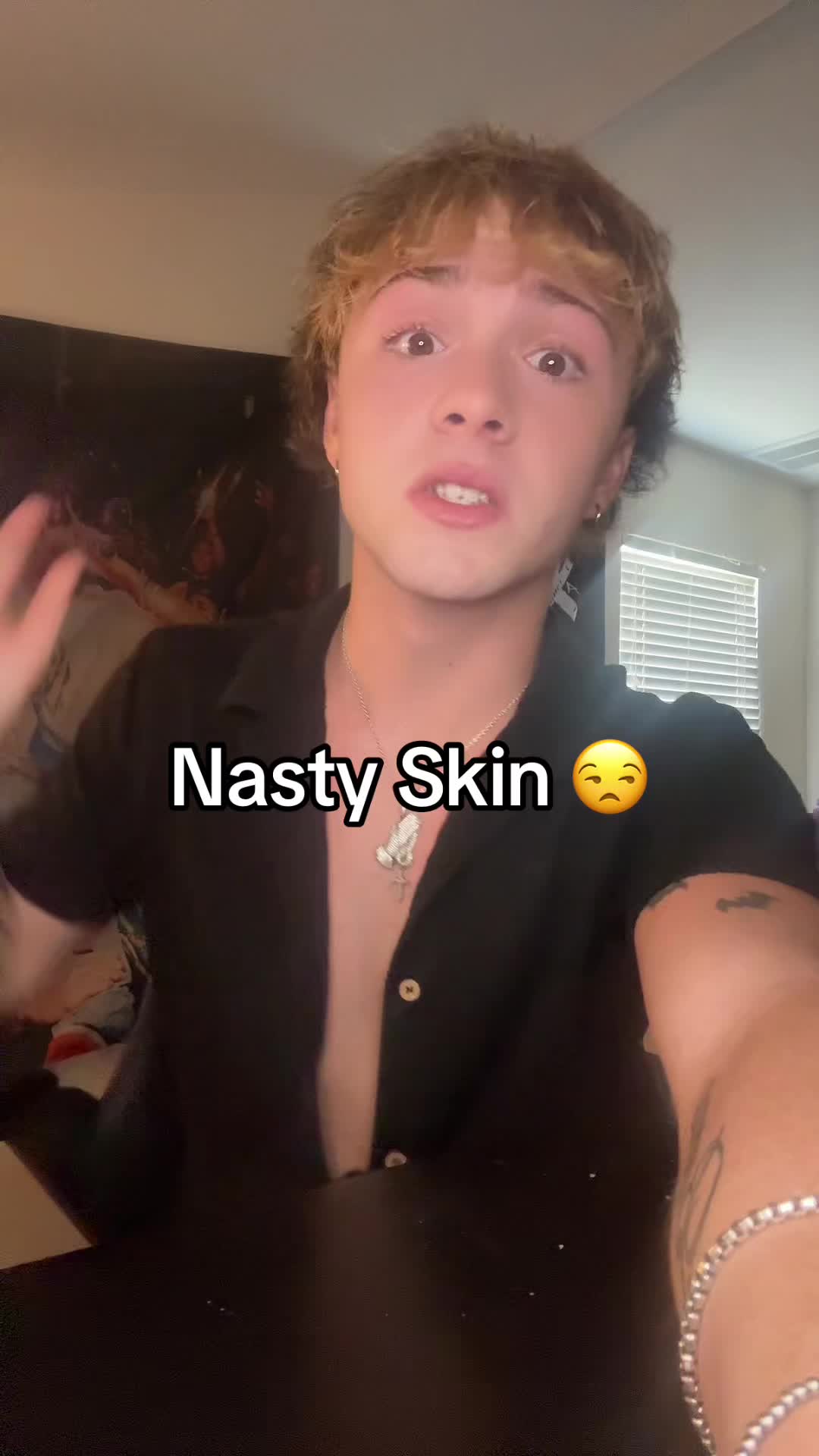 @matt burnss