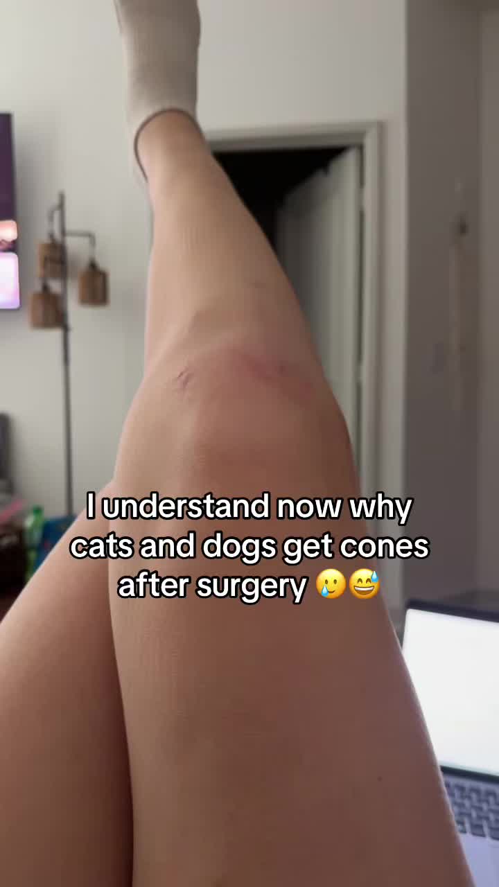 @Shelbs // ACL Recovery ❤️&zwj;🩹
