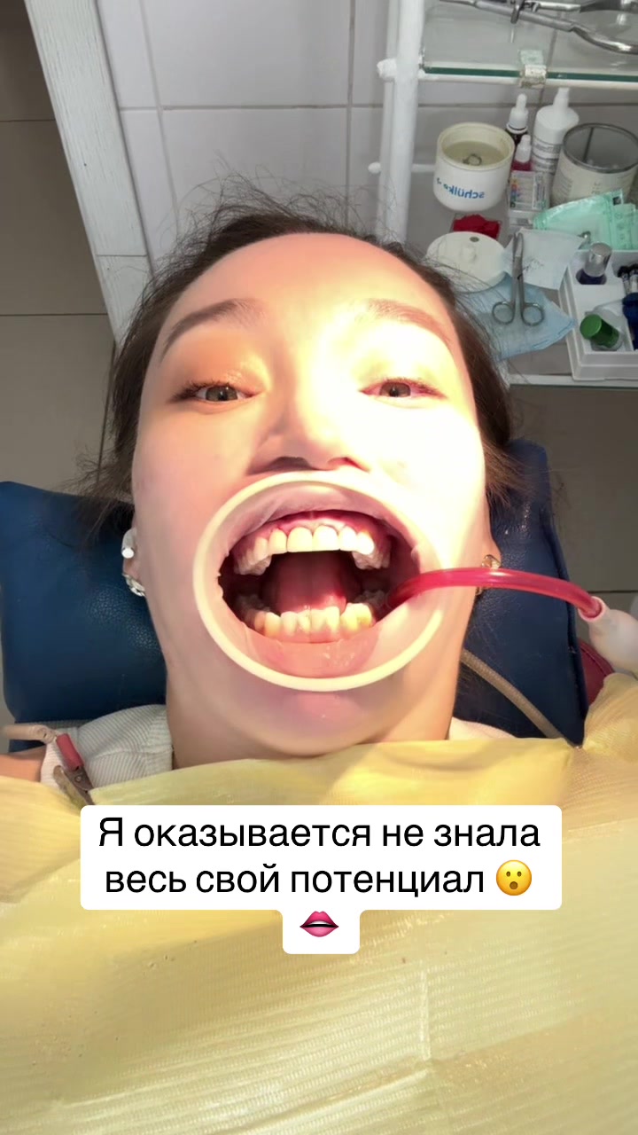 @askdilyara1
