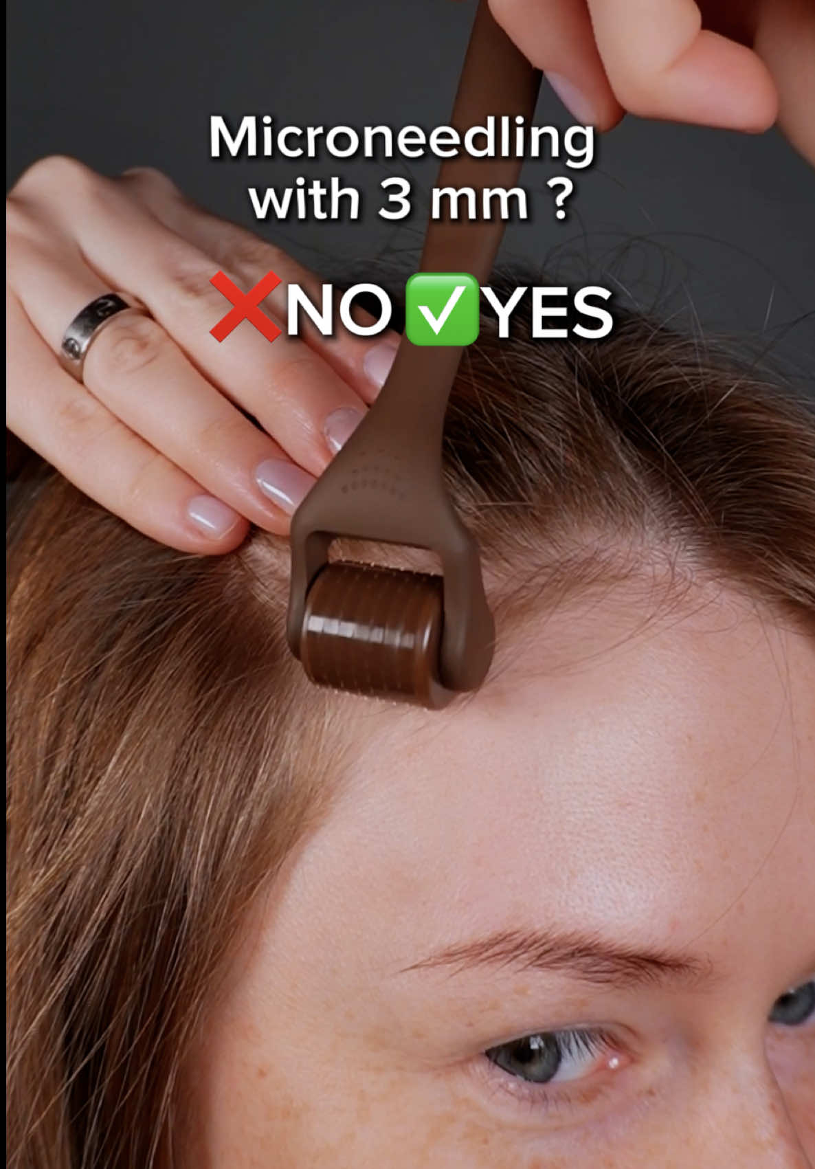 @AVRIN