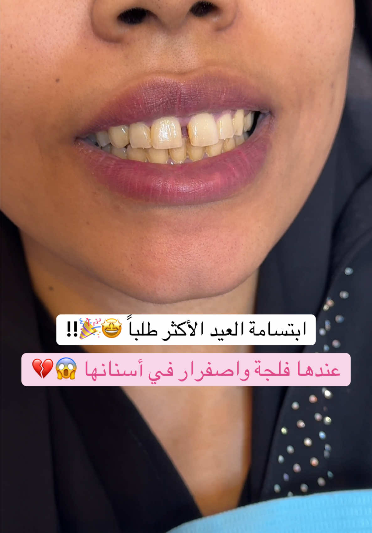 @Dr.lina_almasmoum