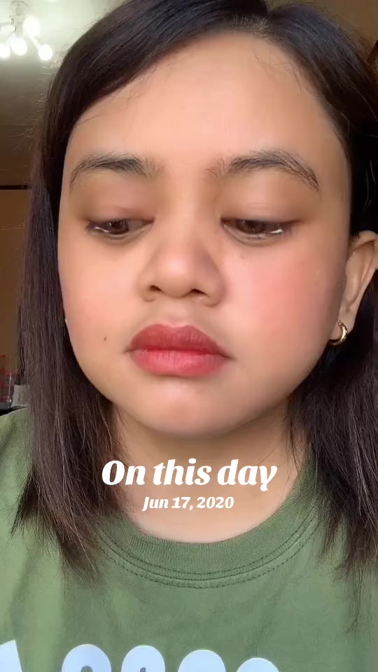 @KIDNEYSERYEQUEEN❤️👸🏻