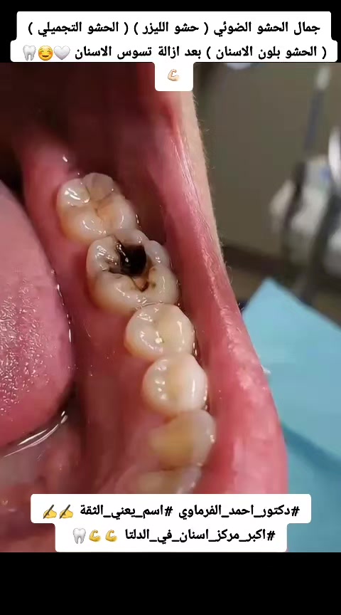 @دكتور احمد طلعت الفرماوي