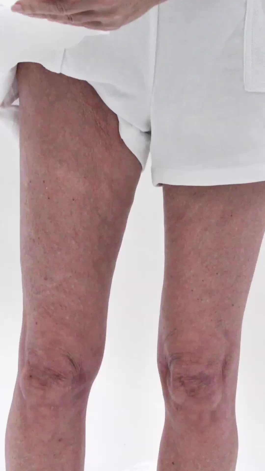 @Skinnies InstantLifts