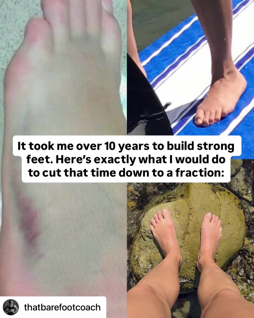 @The Foot Collective