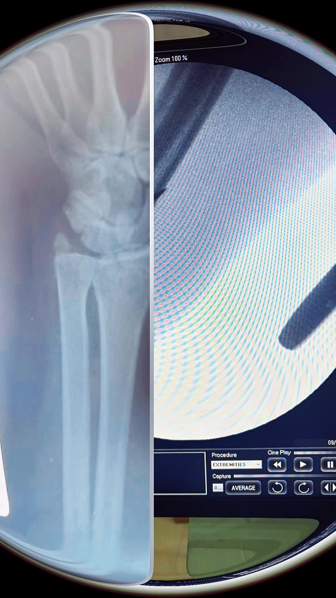 @Spine_Ortho_Surgeon_Arbind