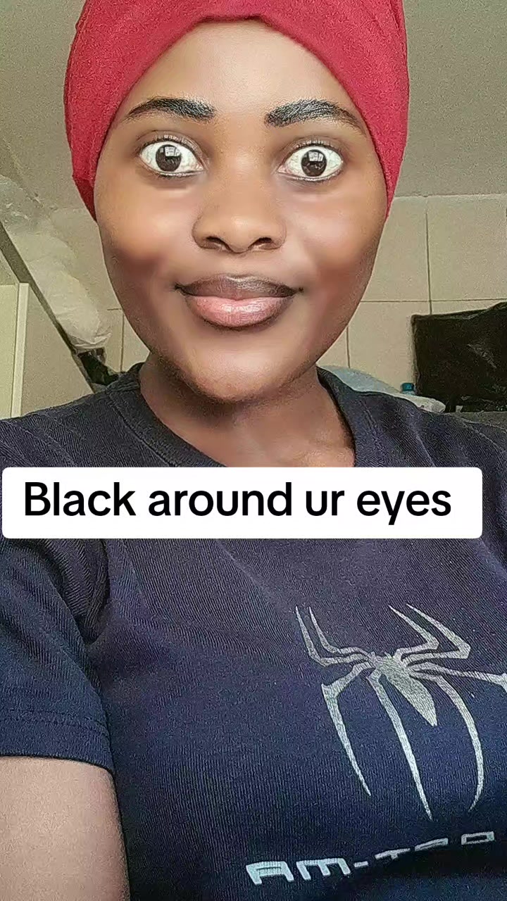 @Anitah Birungi