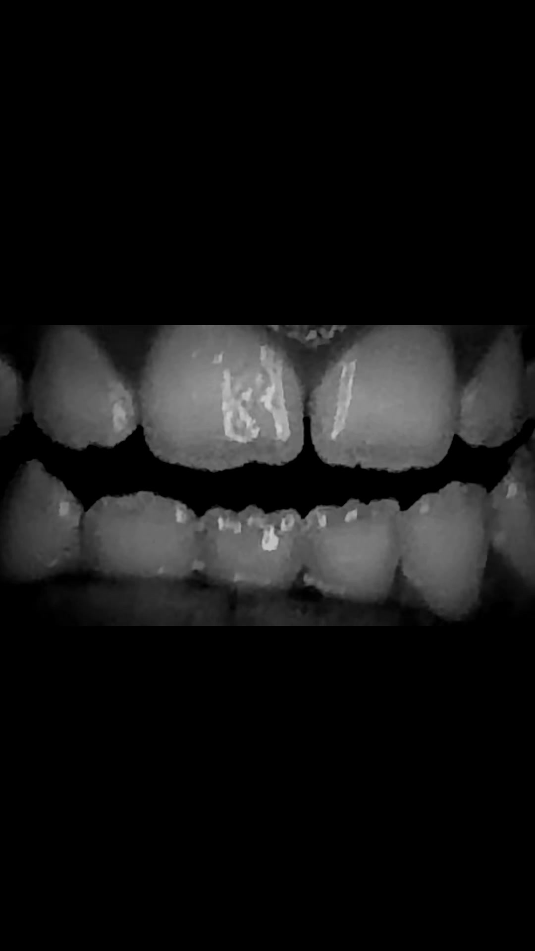 @Mouth singing