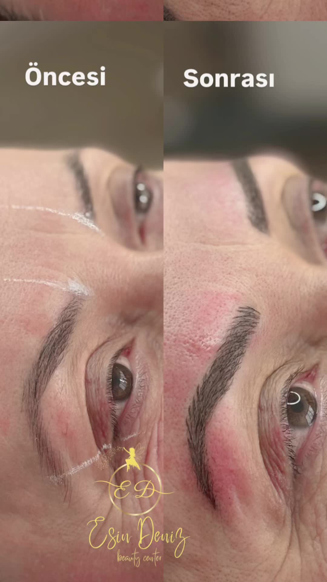@Esin Deniz Beauty center