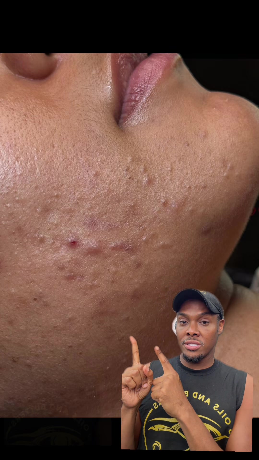 @Ronnie