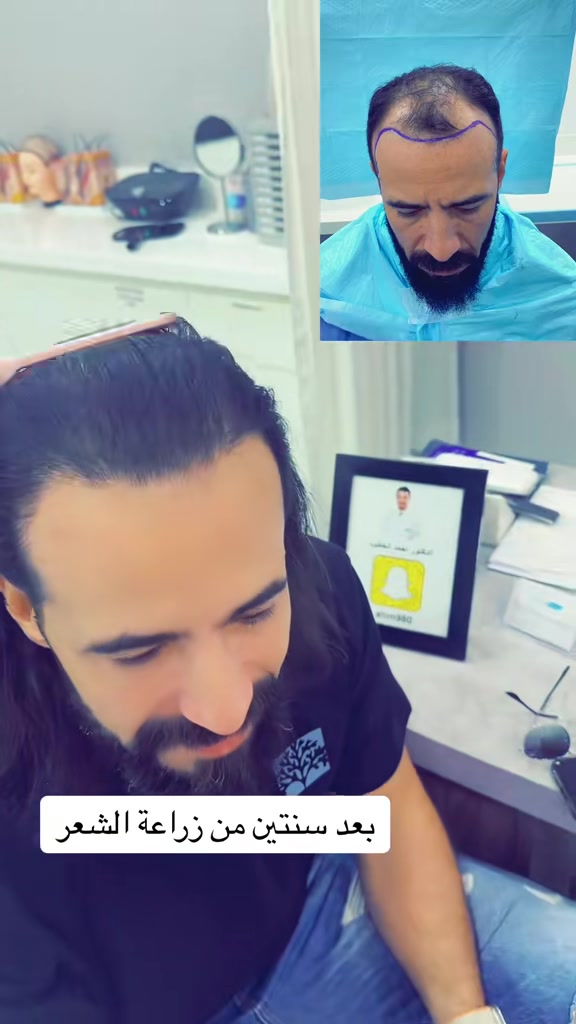 @Dr. Ahmed Alkhateeb