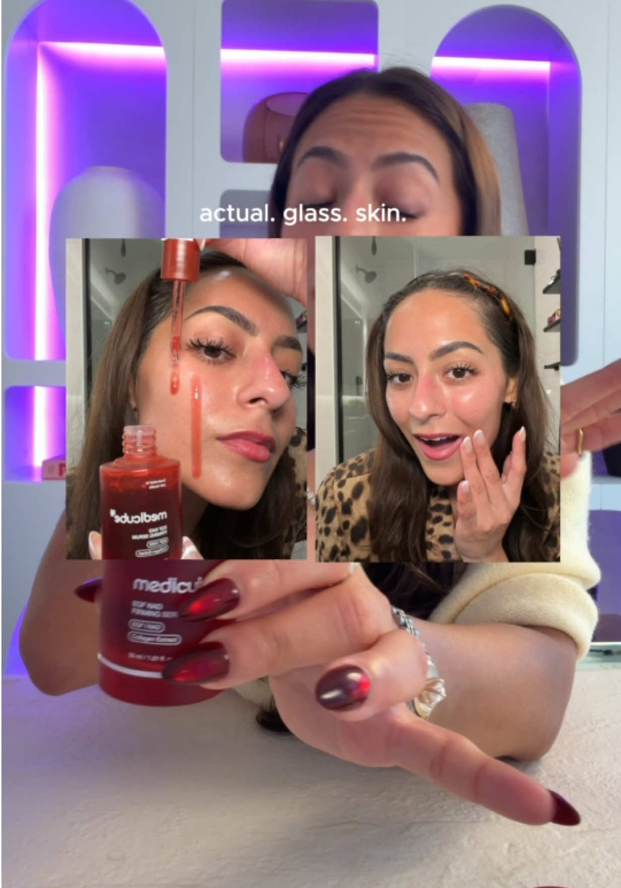@aer 🍒