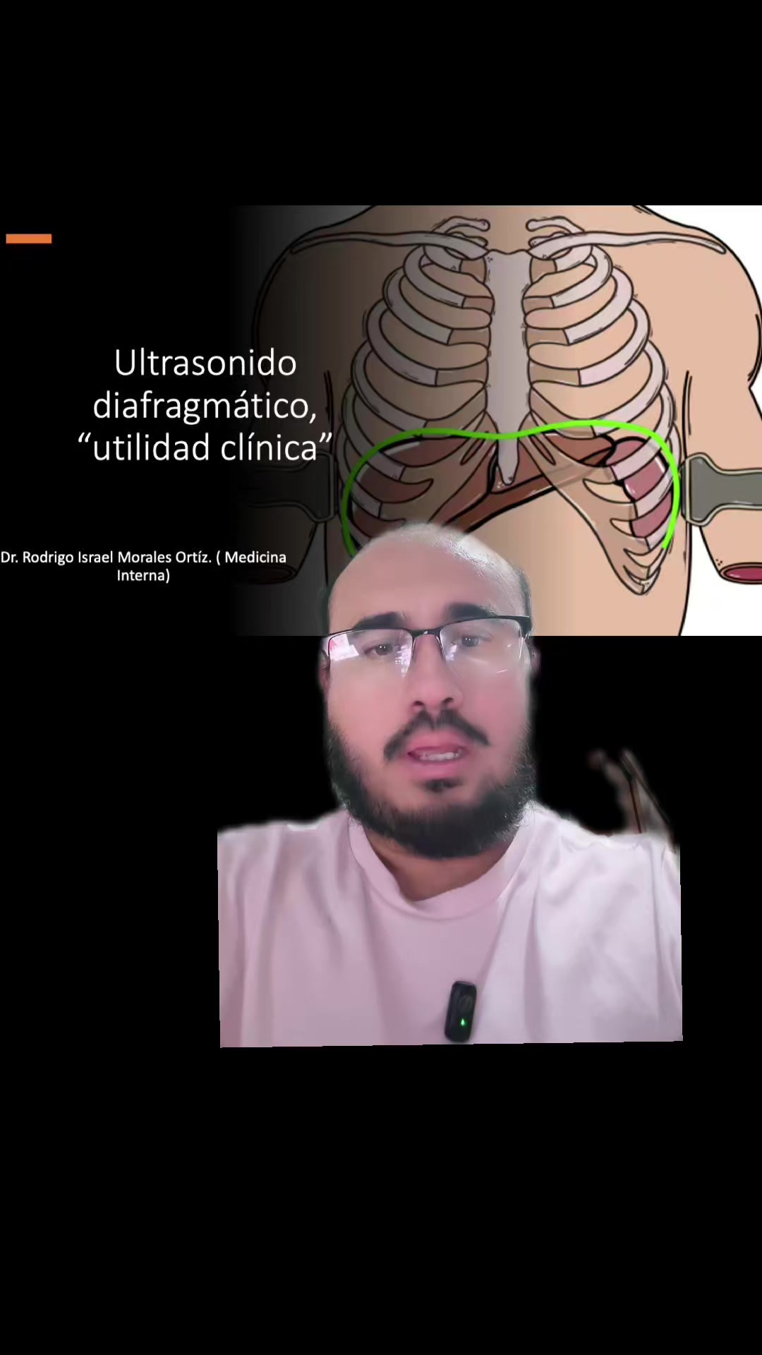 @Dr. Ajolote.
