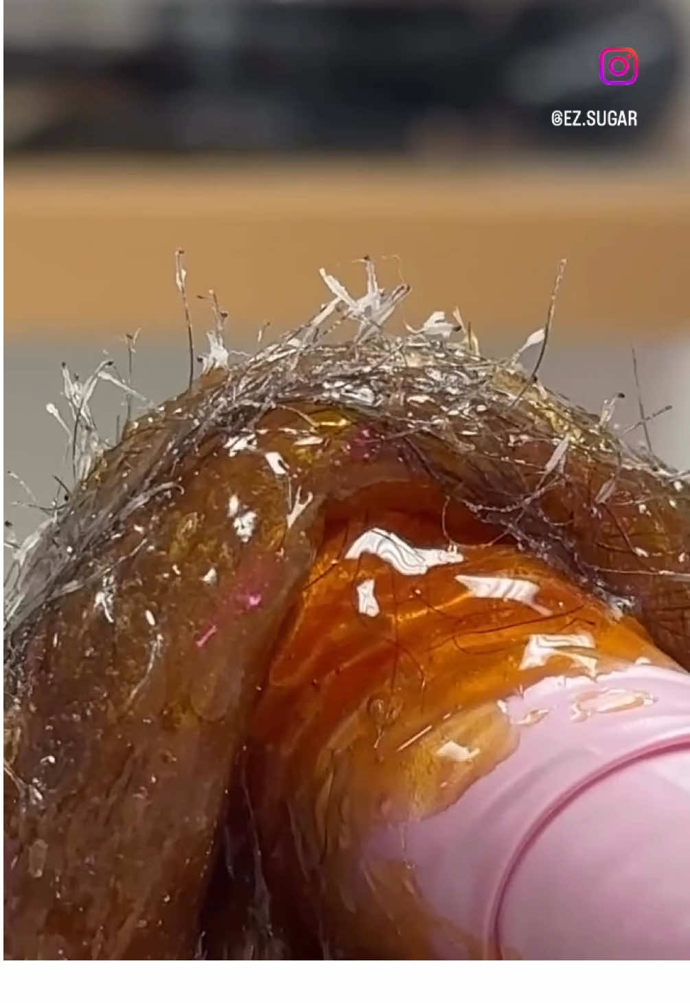 @All Natural Hair Removal