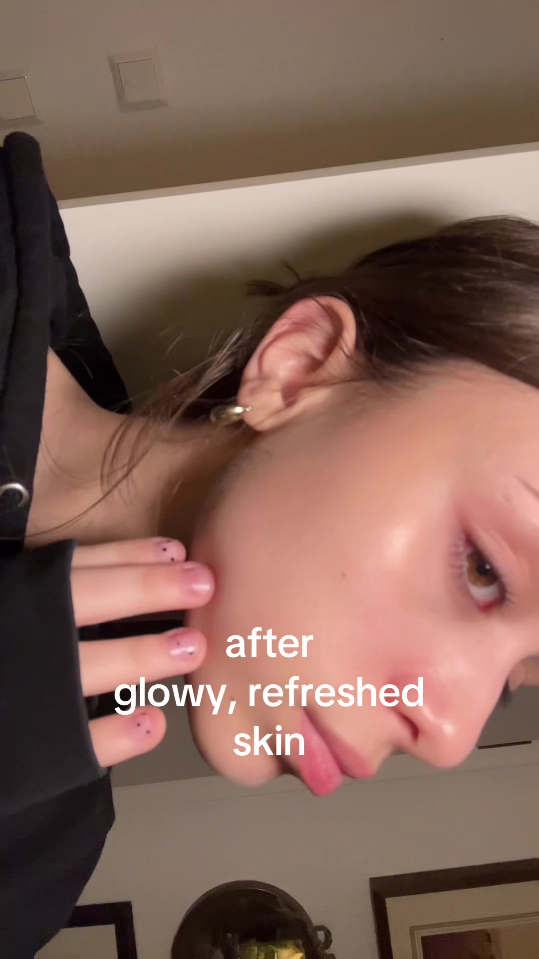 @anesa