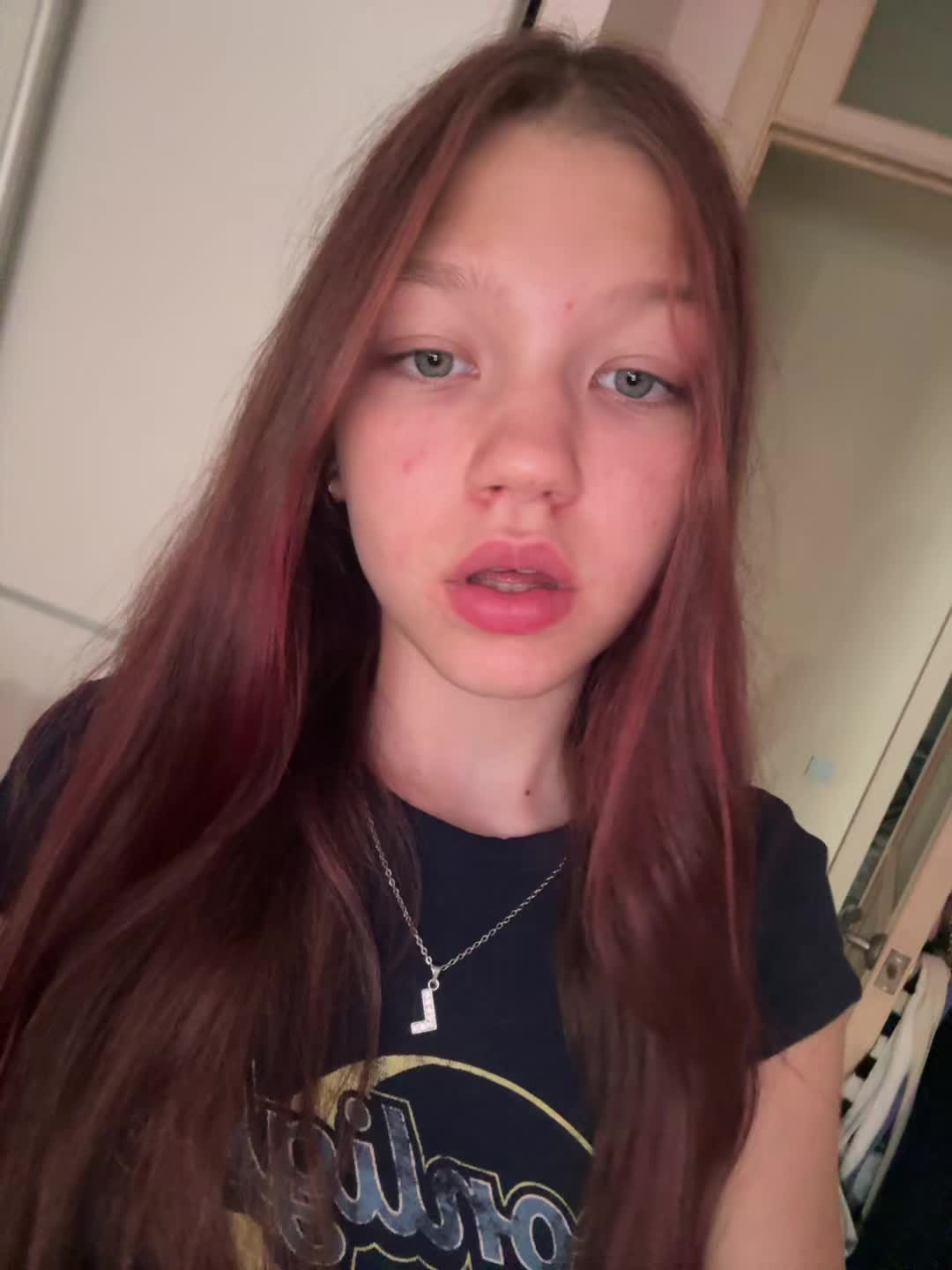 @🫶🏻лизобакт🫶🏻