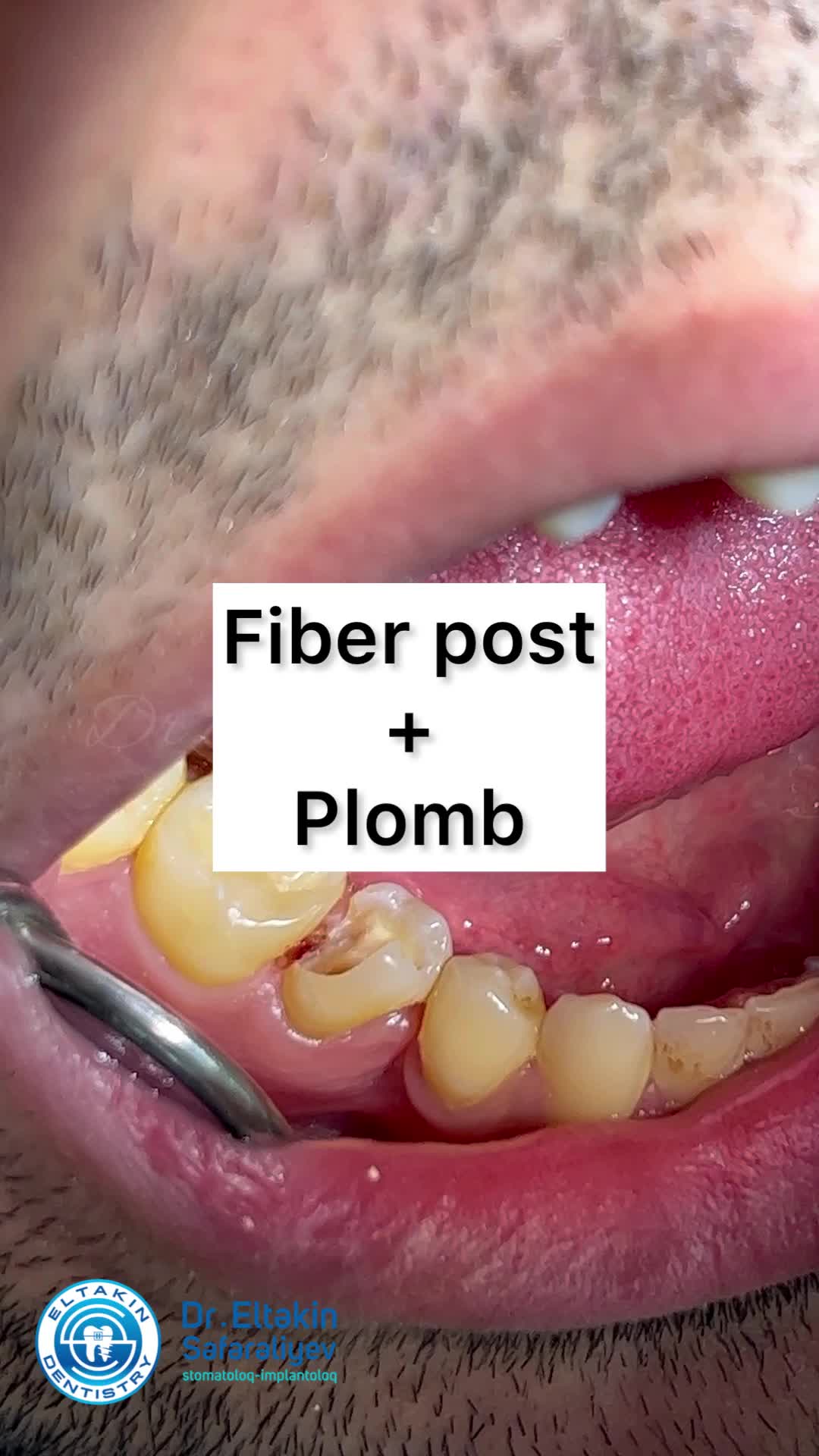 @eltakindentistry