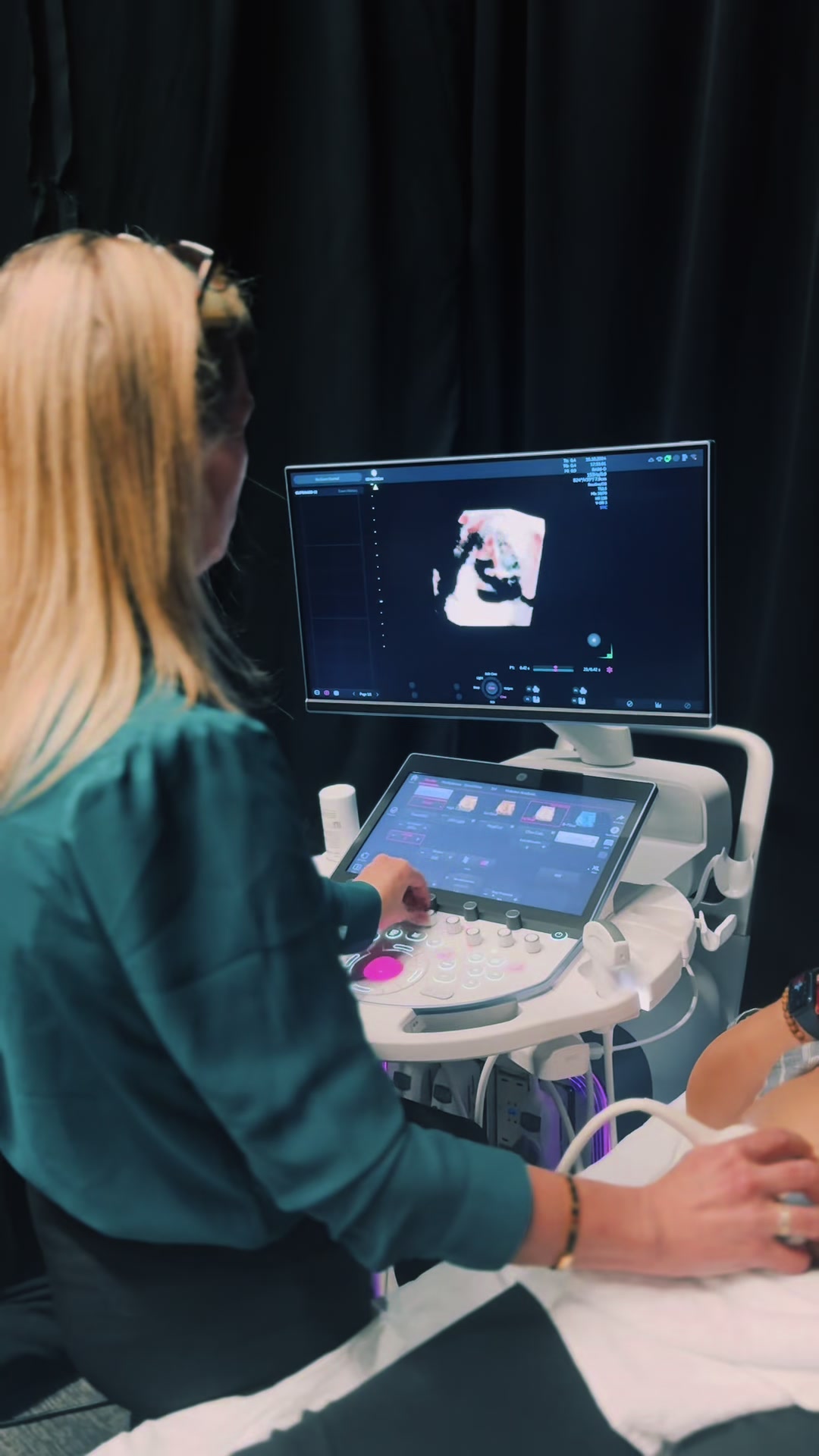@Sonoeyes Ultrasound
