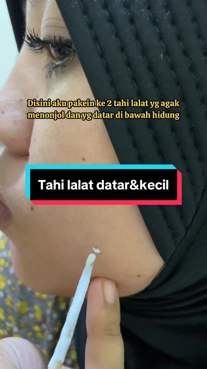 @Penghilangtahilalat.kaq.ay