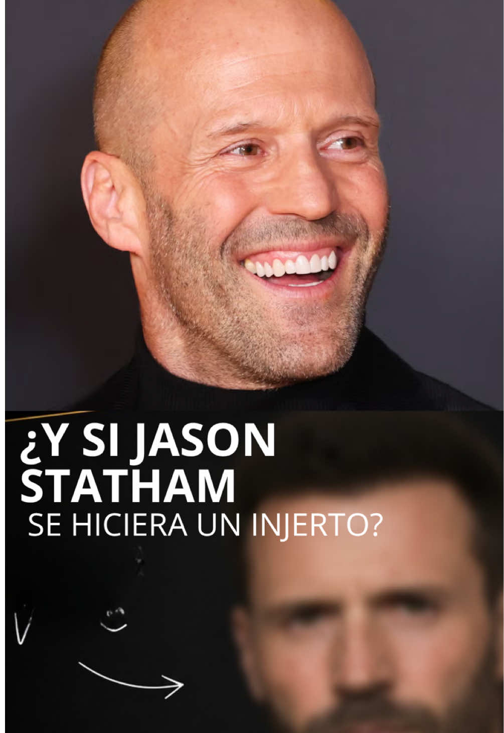 @Clínica Capilar Élite