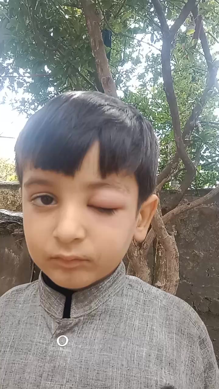 @Dilsuz