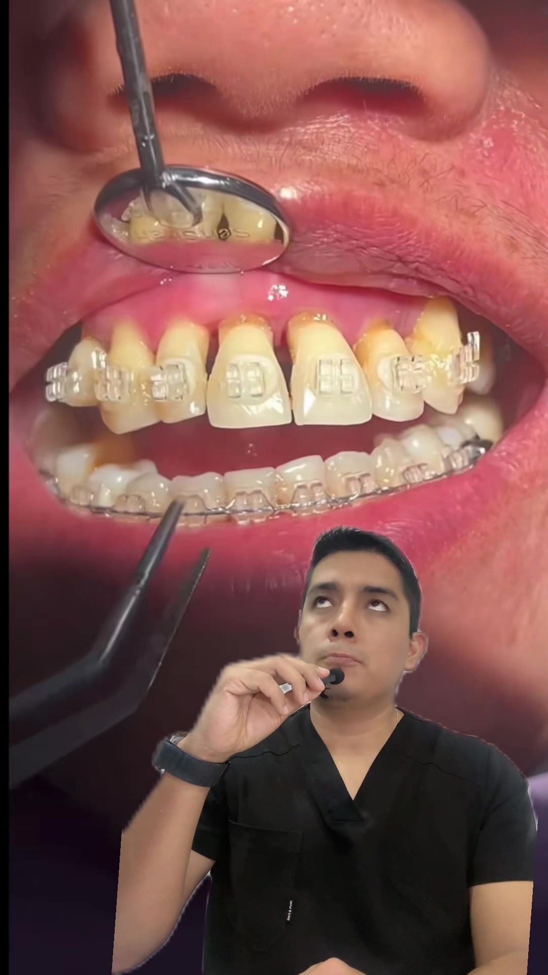 @Dr. Juan Perez | Ortodoncista