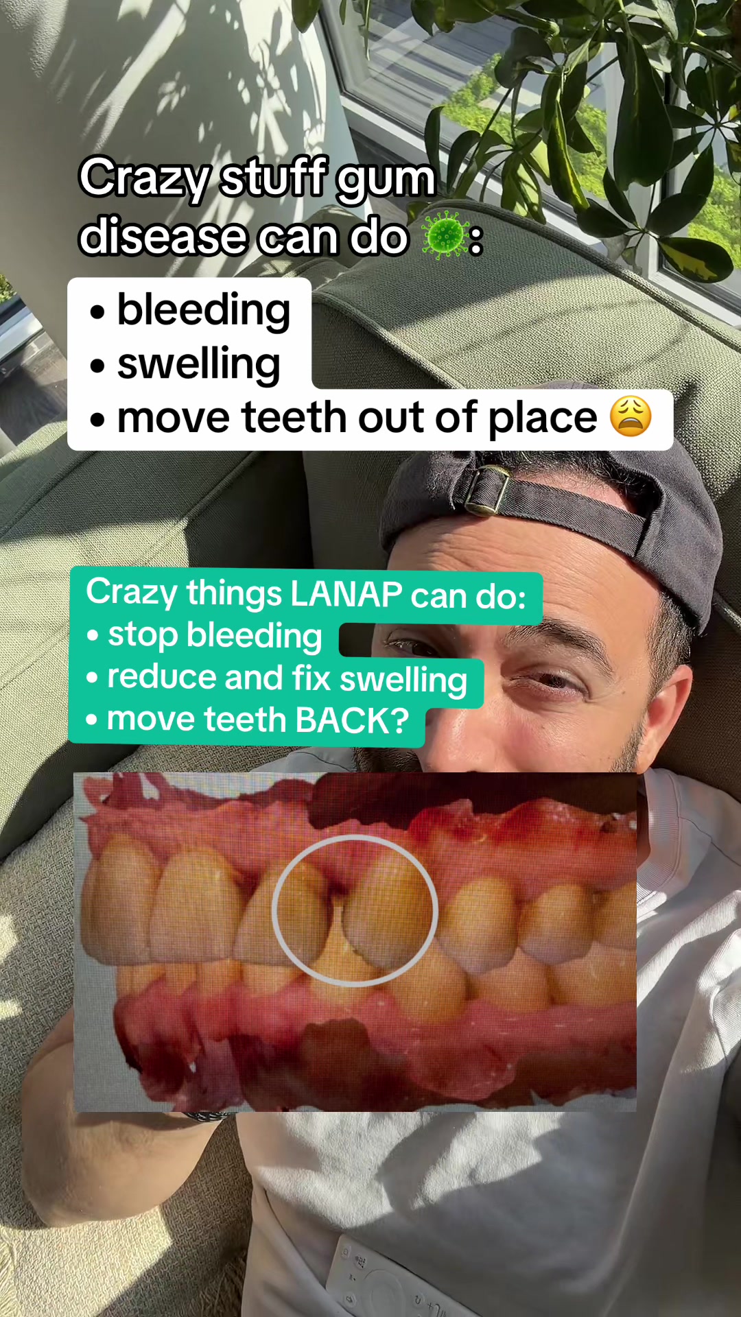 @Dr Cohen Saves Teeth | DDS🦷