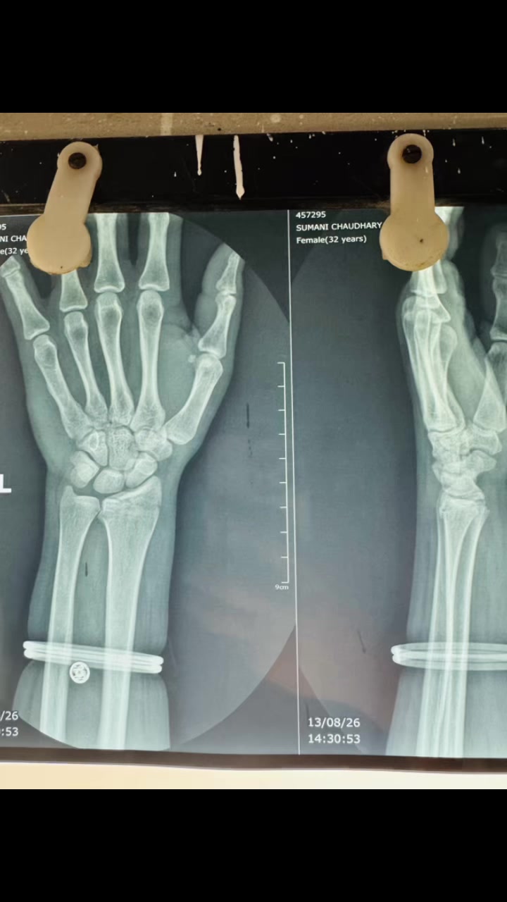 @Dr.Sanjay Gautam,Orthopedics🦴