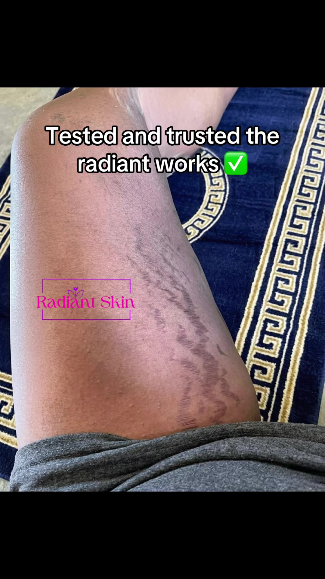 @Radiant skin