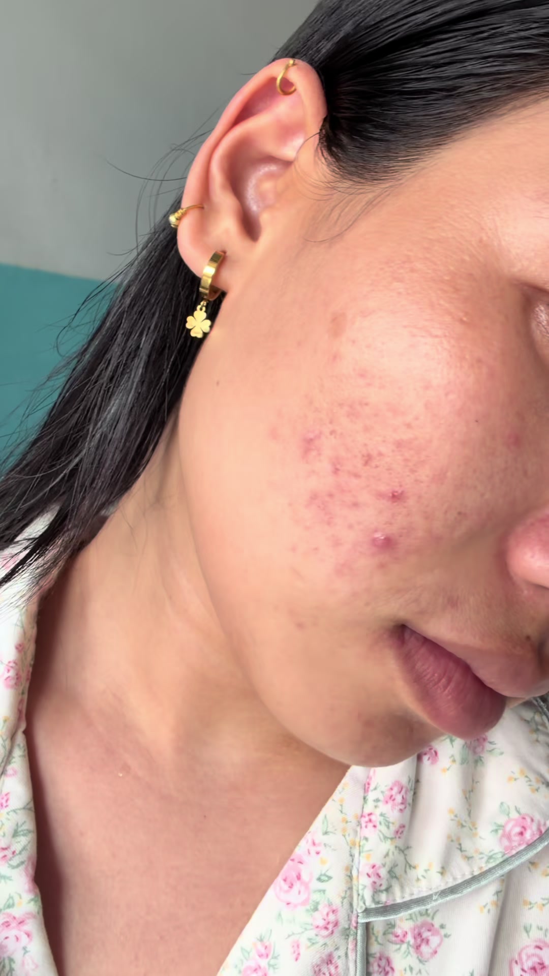 @Styleandskinbysanju
