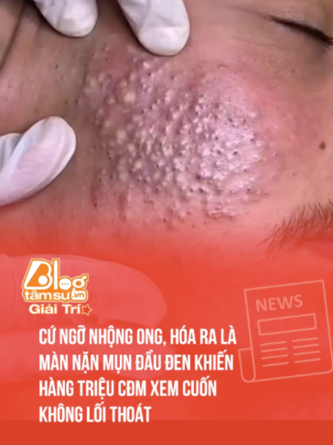 @Blog T&acirc;m Sự Giải Tr&iacute;