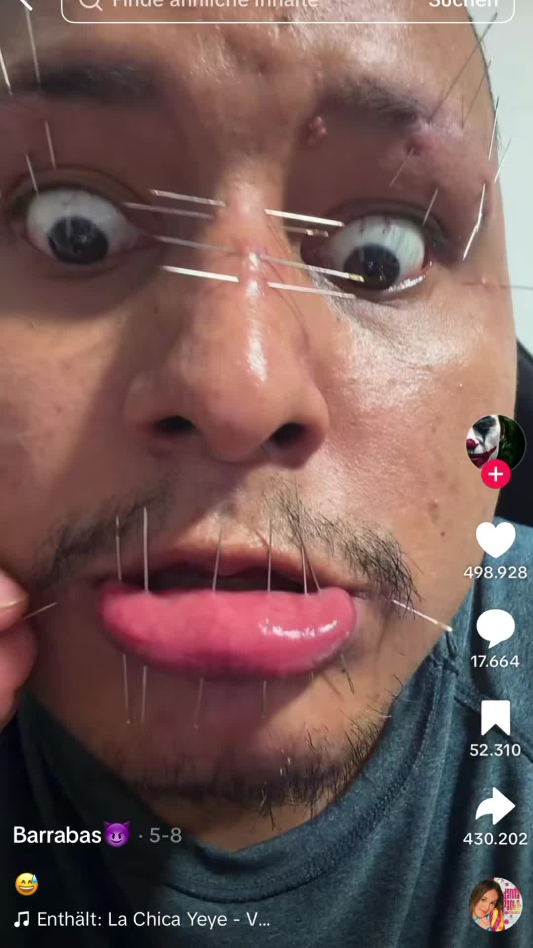 @raphyou10