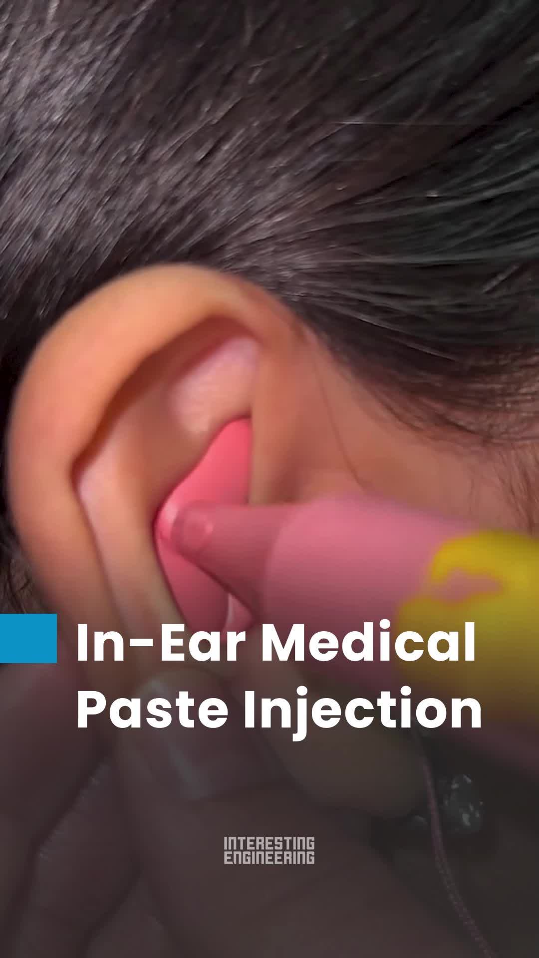 @interestingengineering