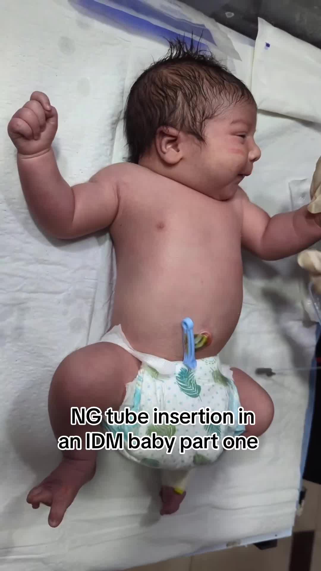 @🥼 CRITICAL NICU BABY 🩺